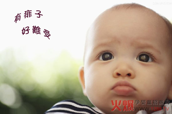 宝宝生痱子的护理方法-婴幼百科-火爆孕婴童招