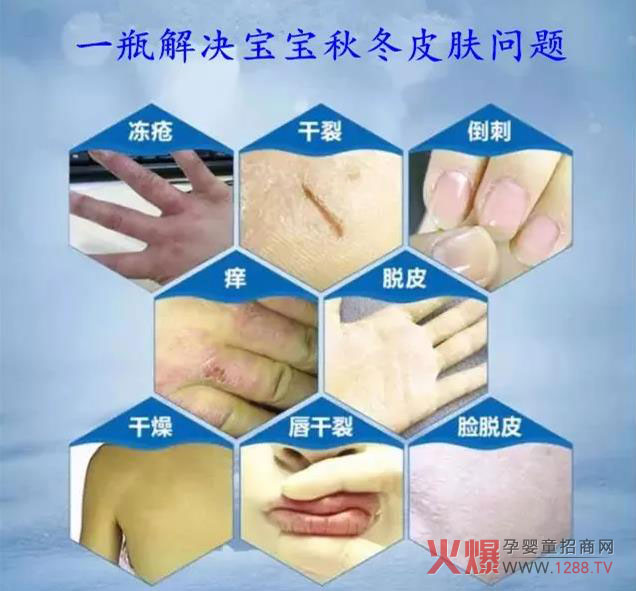 小顽曈婴儿多效防皴霜 预防冬季干燥皴裂