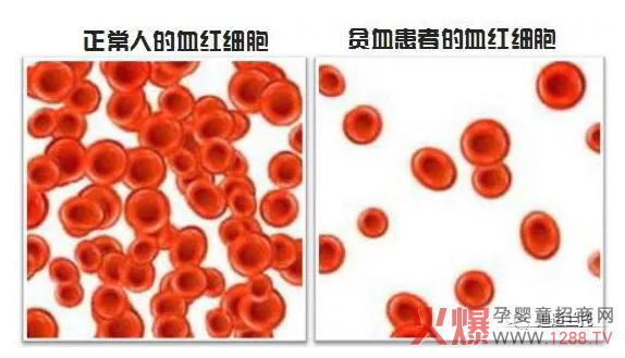 给宝宝补铁要讲究 倍艾姆乳铁蛋白补铁好帮手