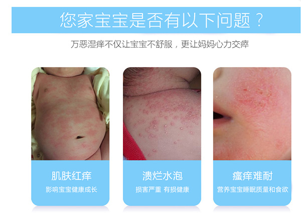 寶寶肌膚常見(jiàn)問(wèn)題.jpg