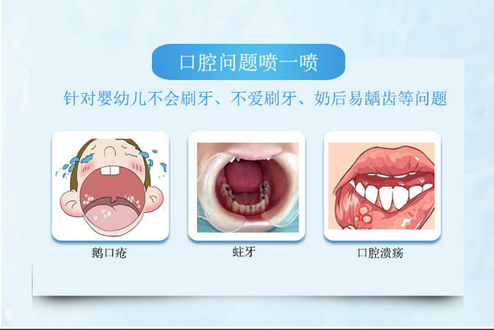  拜拜小蛀牙溶菌酶口腔抑菌噴劑2