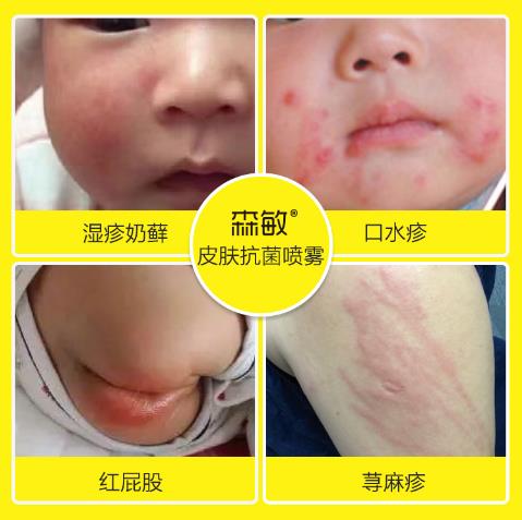 森敏皮膚抗菌噴霧5.jpg